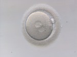 FIV Fecundación In Vitro