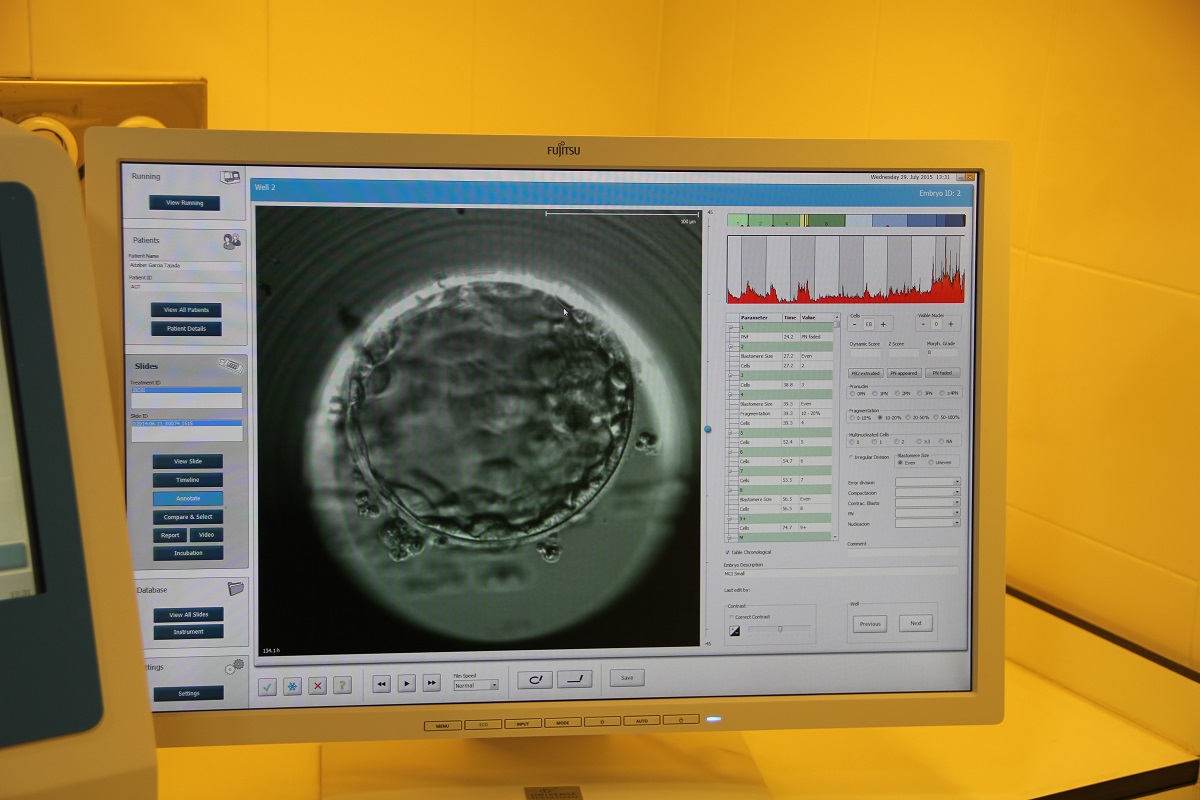 When Is It Best To Transfer The Embryos To Achieve The Highest Chances Of Success On Day 3 Or On Day 5 Ur Vistahermosa En